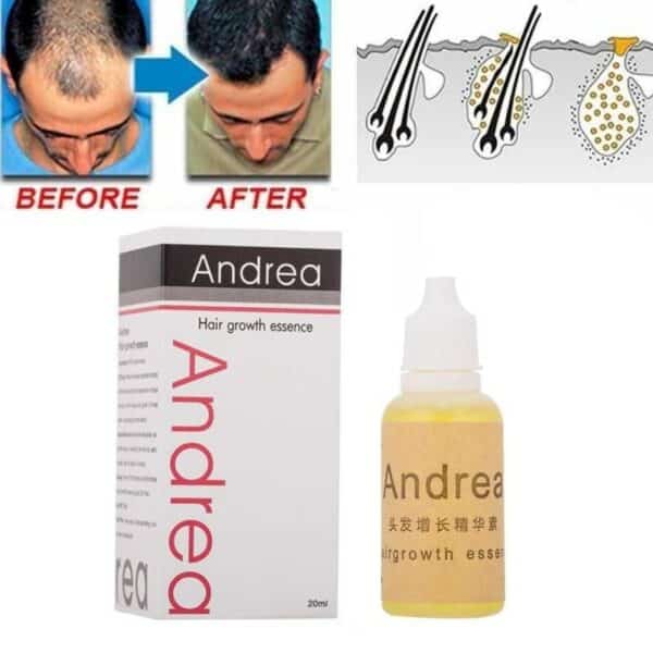 Andrea Hair Growth Oil Essence 100 Natural Plant Extract Growth Serum Thickener Hair Hair Care Loss 2 1