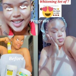 Strong Whitening Set, Skin bleaching Creams, Snow White lotion Oshaprapra Soap